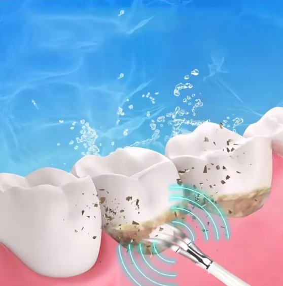 Smart Ultra-Sonic Teeth Cleaner - Image 3