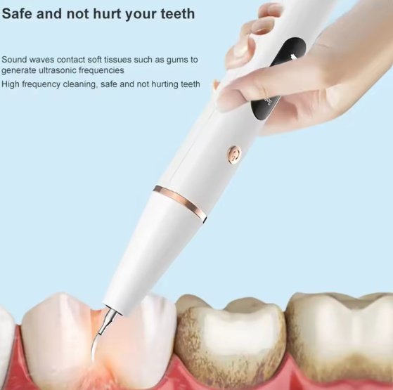 Smart Ultra-Sonic Teeth Cleaner - Image 4